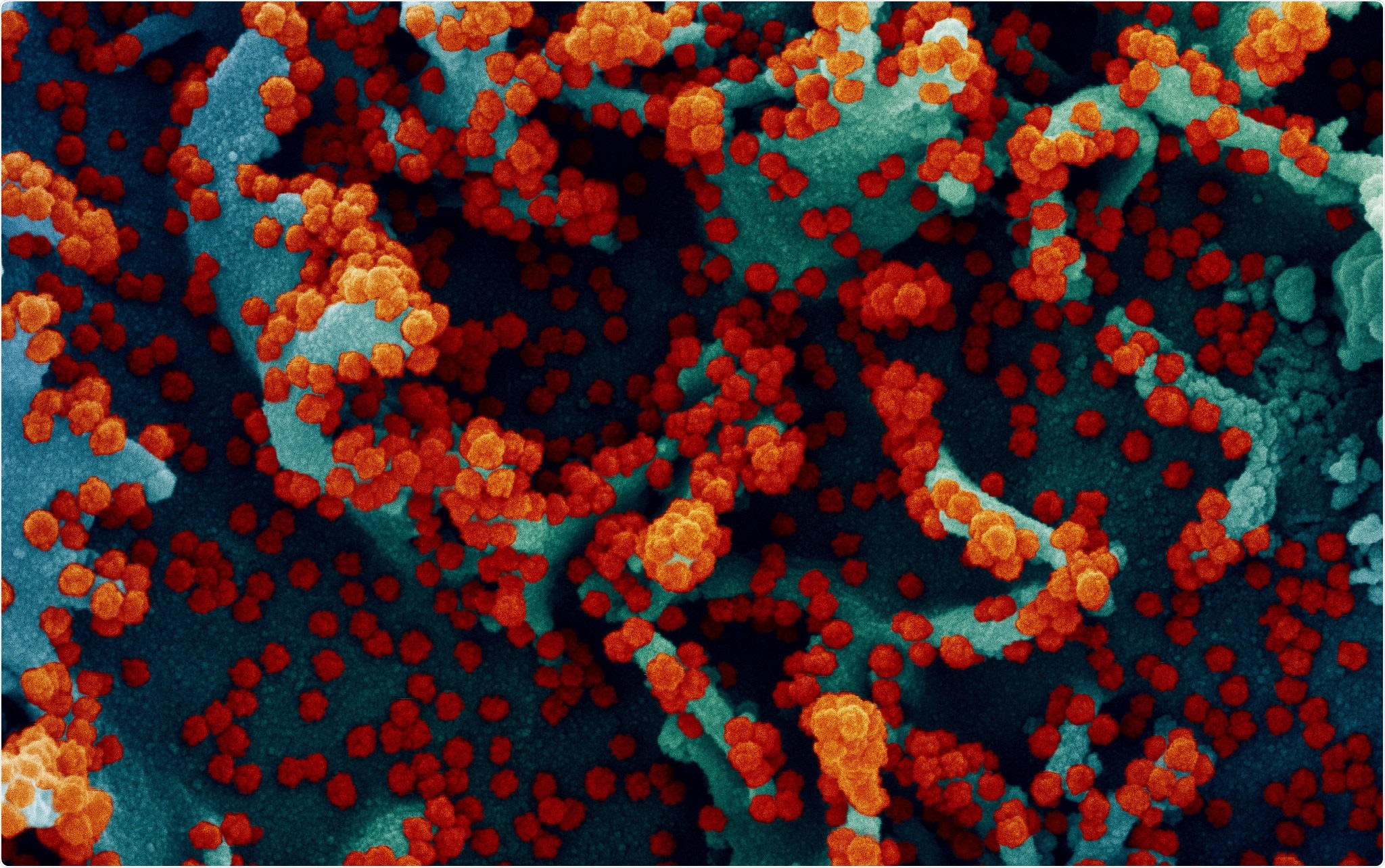 Study: Evaluating the Long-Term Efficacy of COVID-19 Vaccines. Image Credit: NIAID