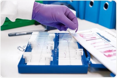 Study reveals new way to target cancer’s nutritional needs