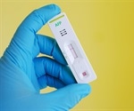 What is the Alpha Fetoprotein Test?