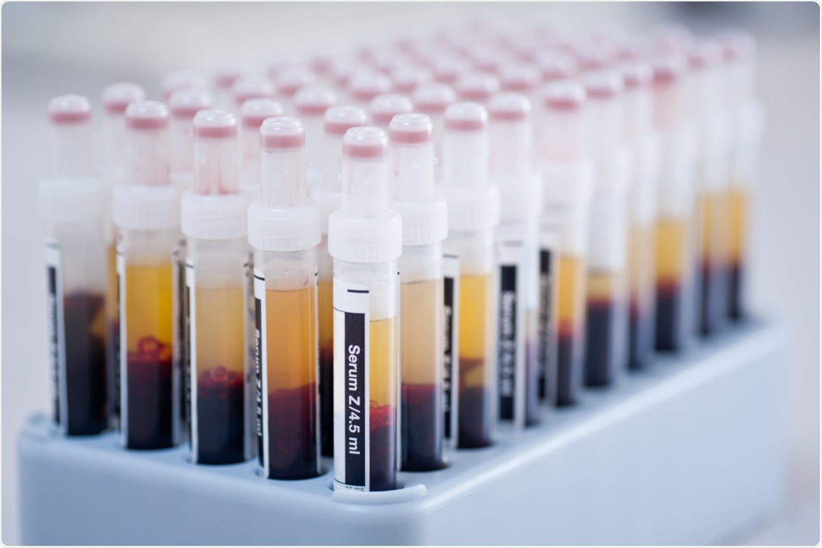 Study: Detection of SARS-Cov-2 RNA in serum is associated with increased mortality risk in hospitalized COVID-19 patients. Image Credit: bajars / Shutterstock