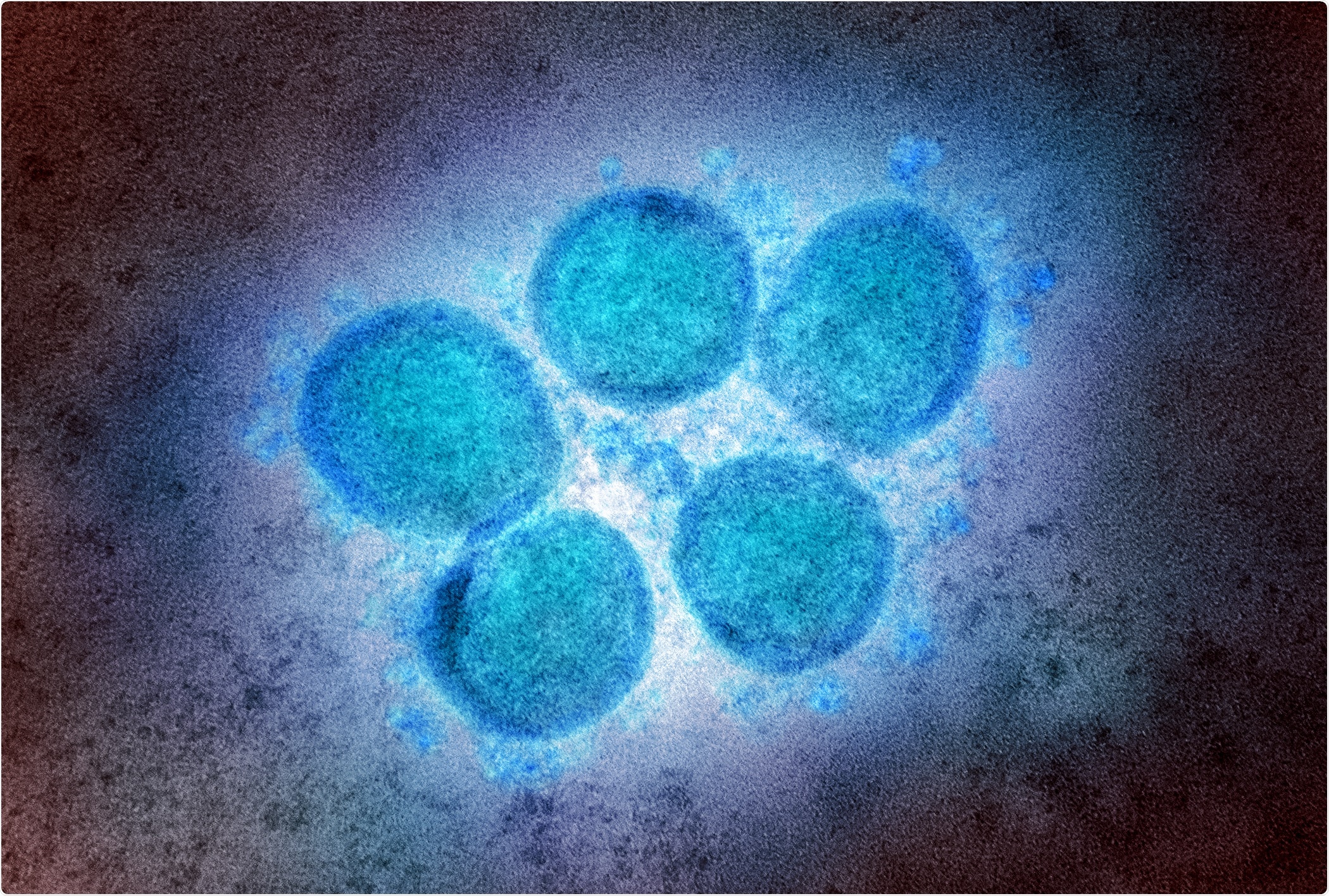 Study: Structure selected RBM immunogens prime polyclonal memory responses that neutralize SARS-CoV-2 variants of concern. Image Credit: NIAID