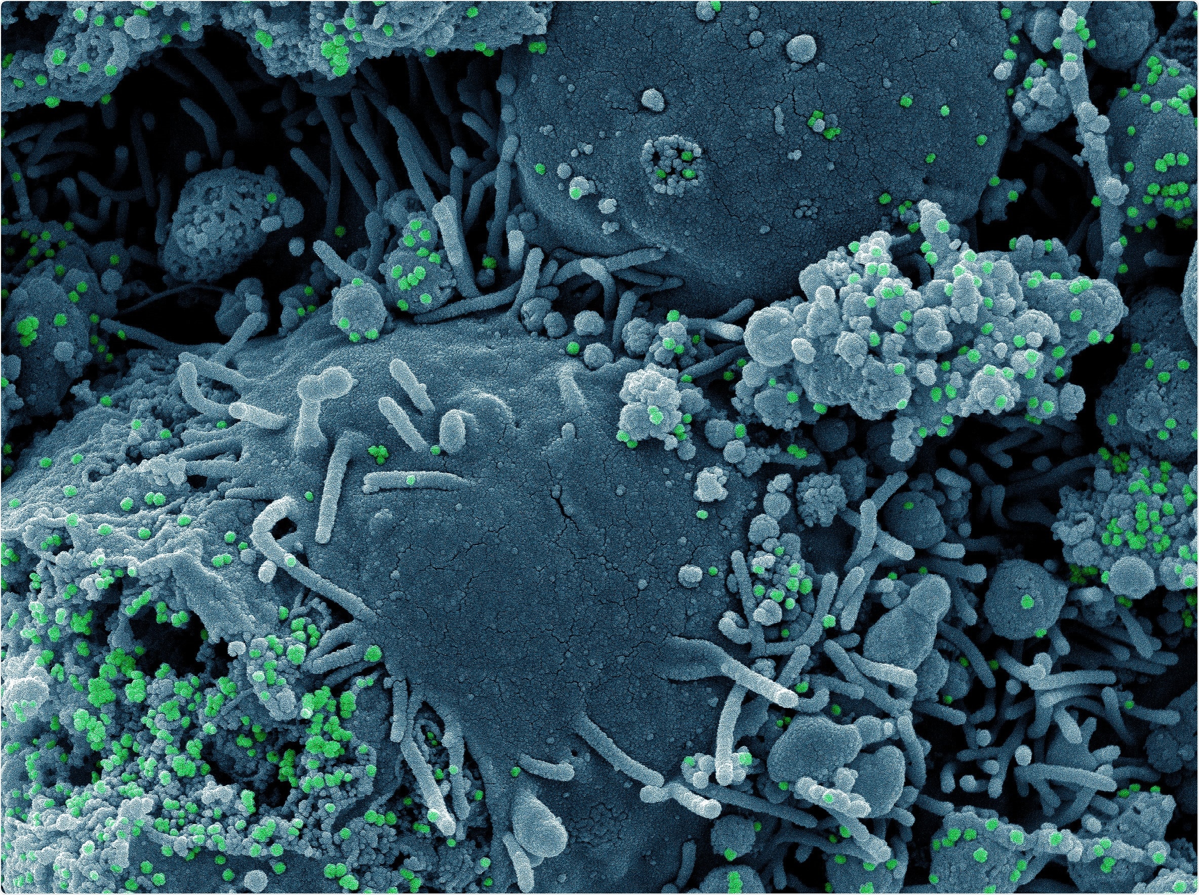 Study: The SARS-CoV-2 Lambda variant and its neutralisation efficiency following vaccination with Comirnaty, Israel, April to June 2021. Image Credit: NIAID