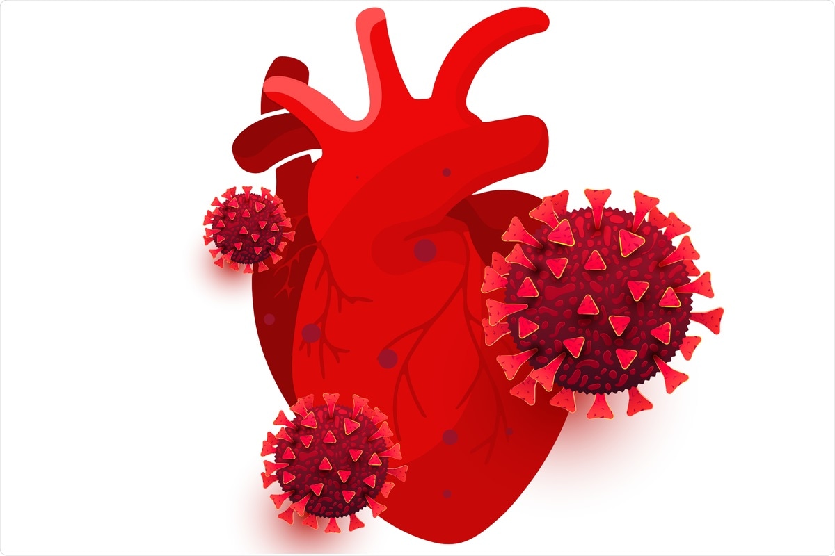 Study: Increased complications of COVID-19 in people with cardiovascular disease: Role of the renin–angiotensin-aldosterone system (RAAS) dysregulation. Image Credit:  Irina Shatilova/ Shutterstock