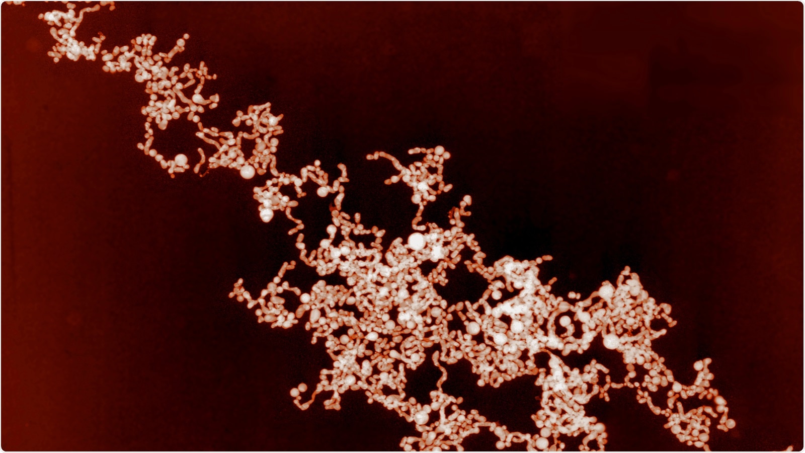 Study: Metal Nanoparticles against Viruses: Possibilities to Fight SARS-CoV-. Image Credit: Georgy Shafeev / Shutterstock