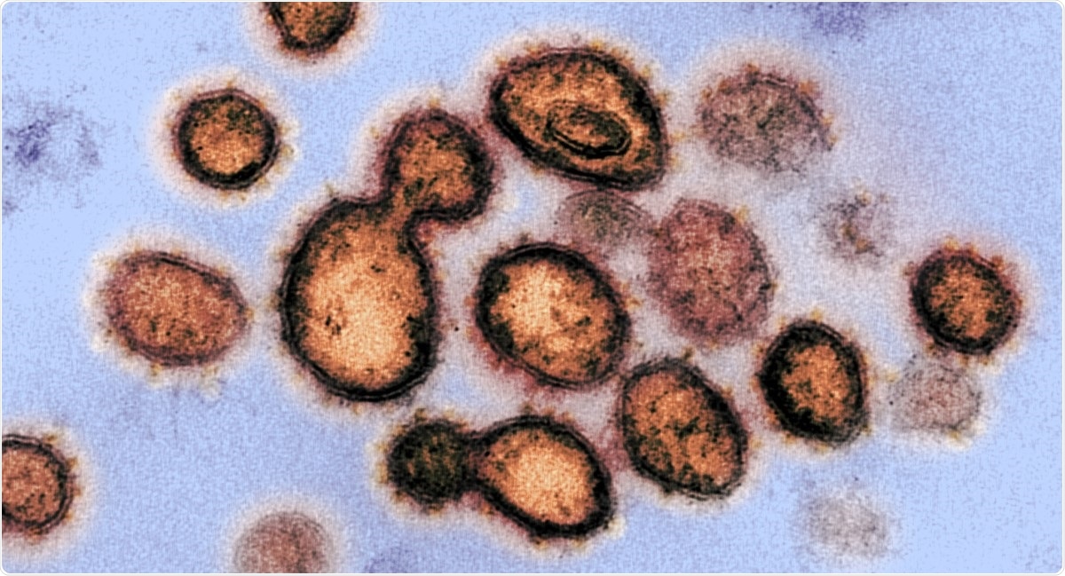 Study: Insights from the comparisons of SARS-CoV and COVID-19 outbreaks. Image Credit: NIAID / Flickr