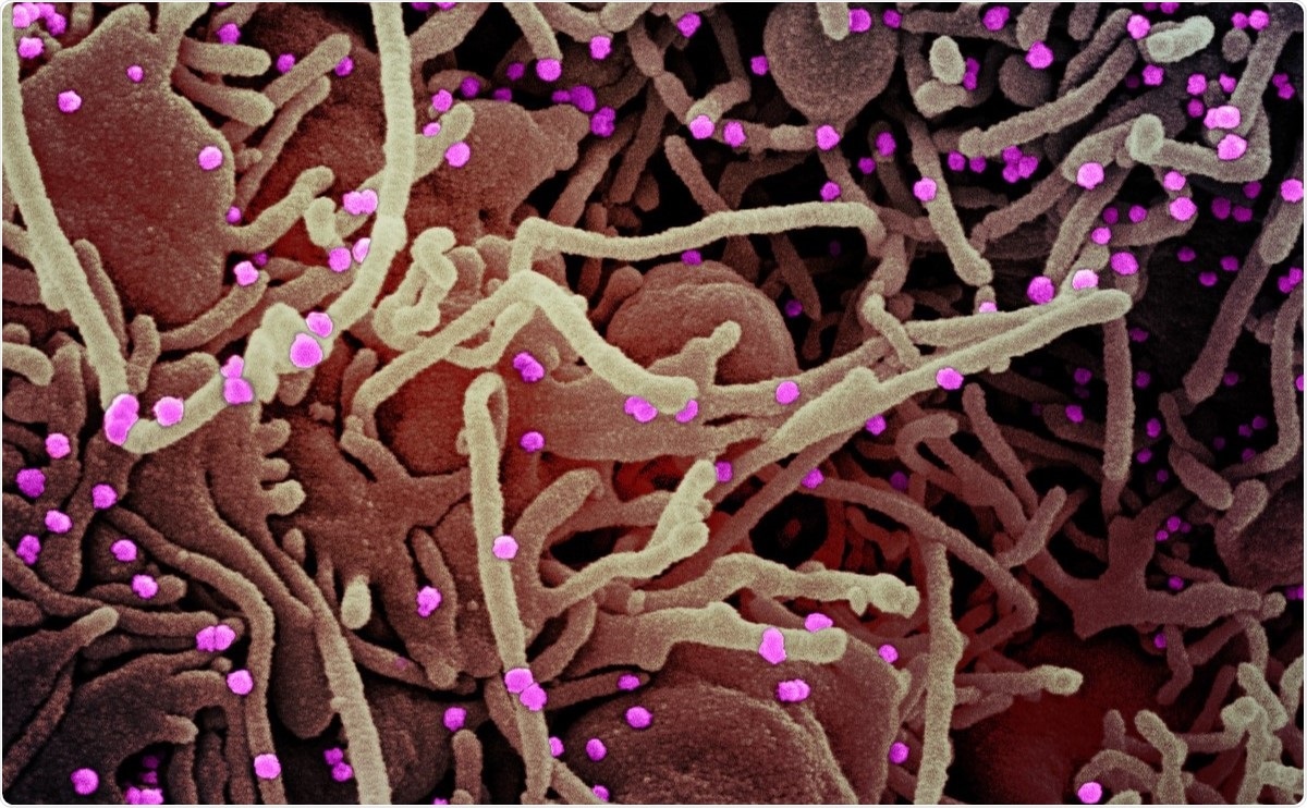 Study: Deleterious effects of SARS-CoV-2 infection on human pancreatic cells. Image Credit: NIAID / Flickr