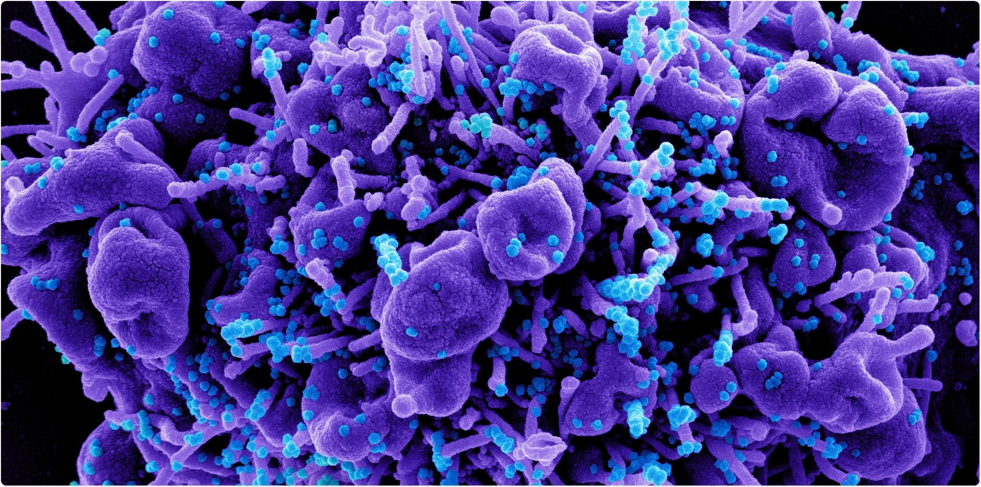 Study: SARS-CoV-2 infection drives a glycan switch of peripheral T cells at diagnosis. Image Credit: NIAID