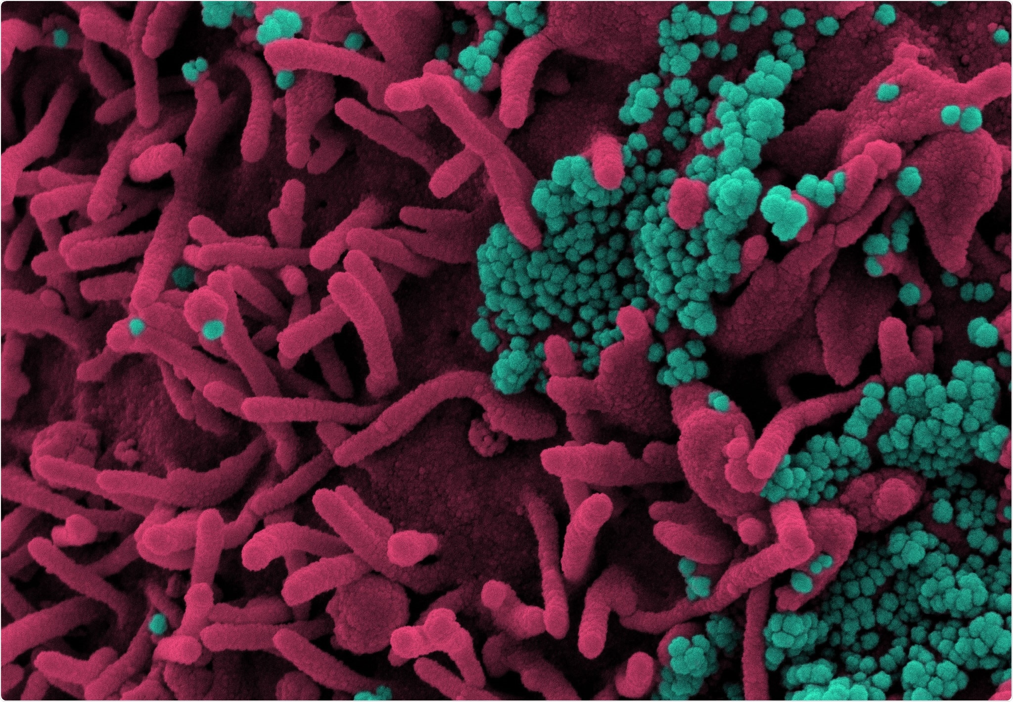 Study: An early assessment of the epidemiological effects of SARS-CoV-2 variants of concern in Germany. Image Credit: NIAID