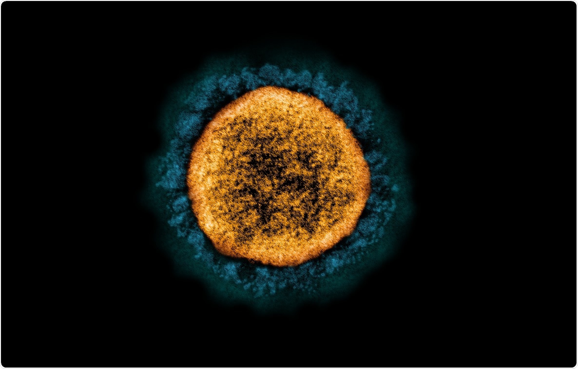 Study: Implications of central carbon metabolism in SARS-CoV-2 replication and disease severity. Image Credit: NIAID