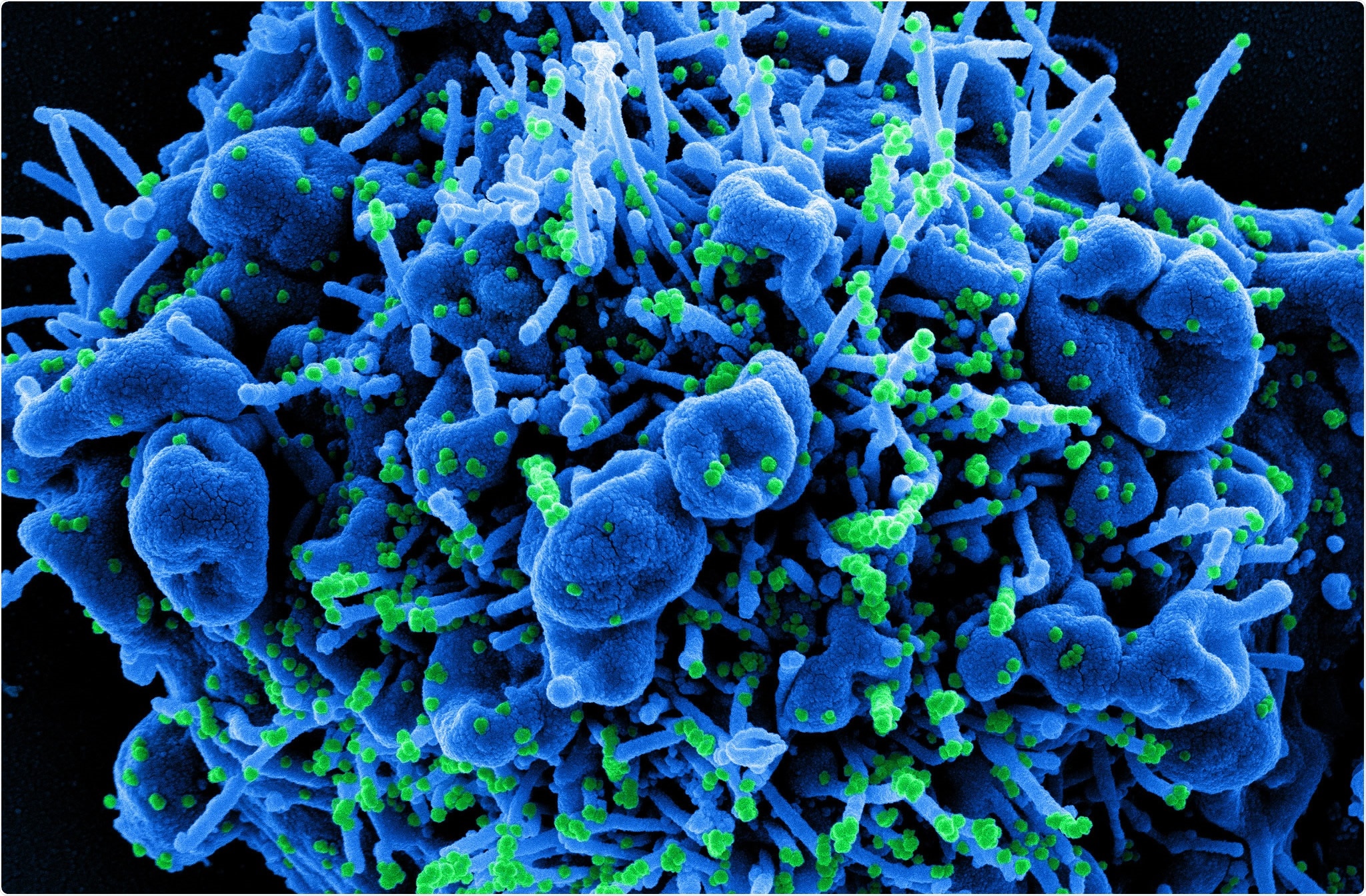 Study: SARS-CoV-2 infection and transmission in primary schools in England in June–December 2020 (sKIDs): an active, prospective surveillance study. Image Credit: NIAID