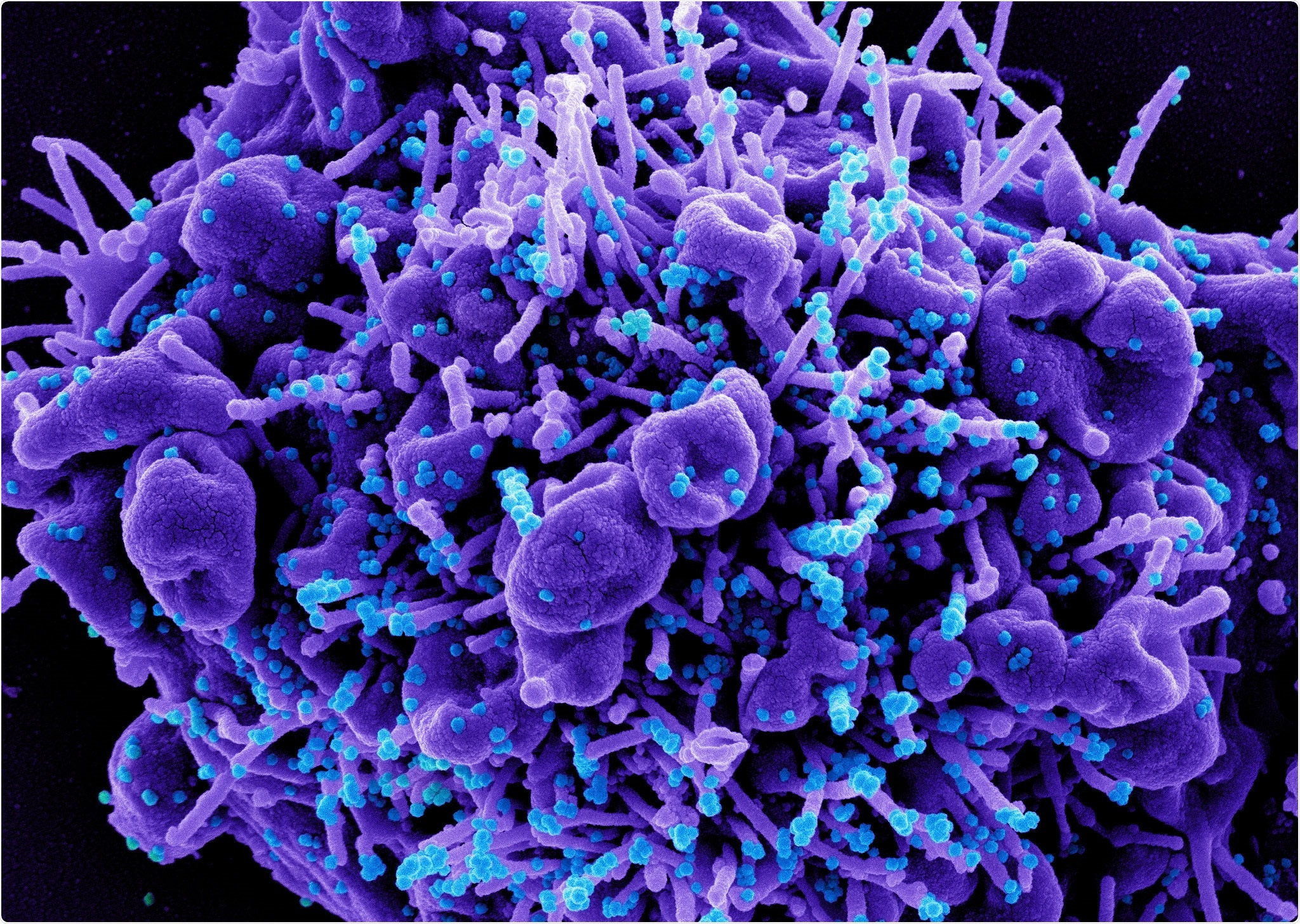 Study: Comparative studies of the seven human coronavirus envelope proteins using topology prediction and molecular modelling to understand their pathogenicity. Image Credit: NIAID