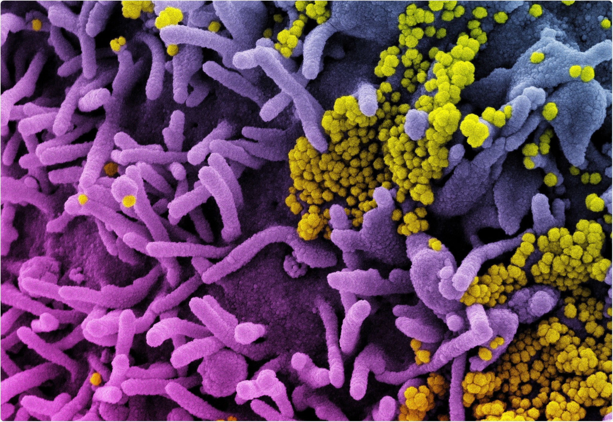 Study: Circular RNA Vaccines against SARS-CoV-2 and Emerging Variants. Image Credit: NIAID