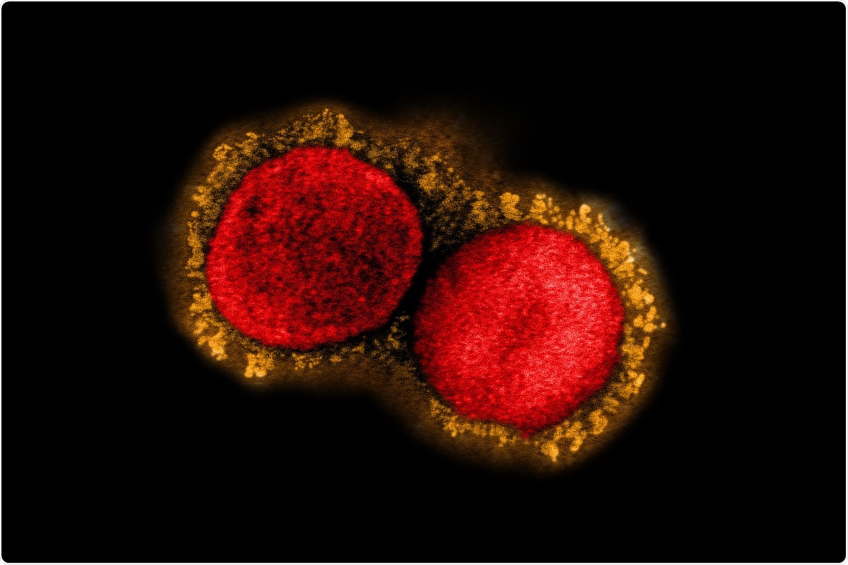 Study: Emergence of a SARS-CoV-2 E484K variant of interest in Arizona. Image Credit: NIAID