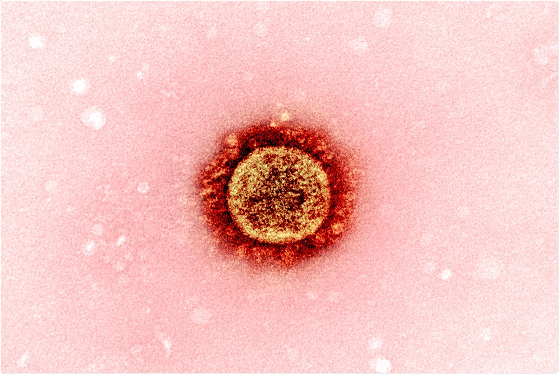 Study: Early Antibody Responses Associated with Survival in COVID19 Patients. Image Credit: NIAID