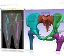 Synopsys Introduce New & Improved AI-Enabled Solutions for Segmentation & Landmarking in Orthopedics & Cardiology