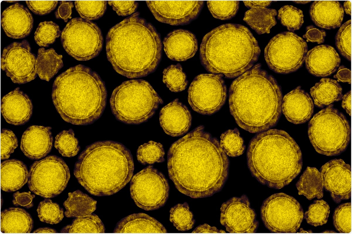 Study: Shotgun transcriptome, spatial omics, and isothermal profiling of SARS-CoV-2 infection reveals unique host responses, viral diversification, and drug interactions. Image Credit: Edgloris Marys / Shutterstock
