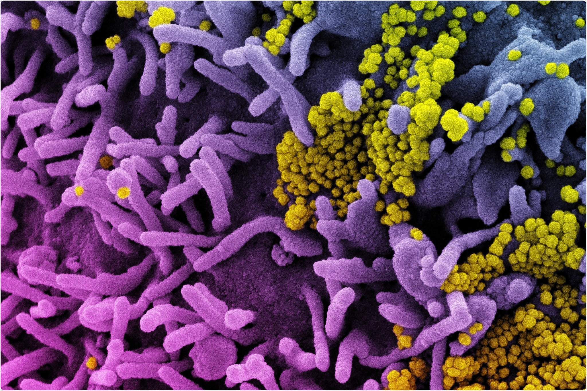 Study: Antiviral zinc oxide nanoparticles mediated by hesperidin and in silico comparison study between antiviral phenolics as anti-SARS-CoV-2. Image Credit: NIAID