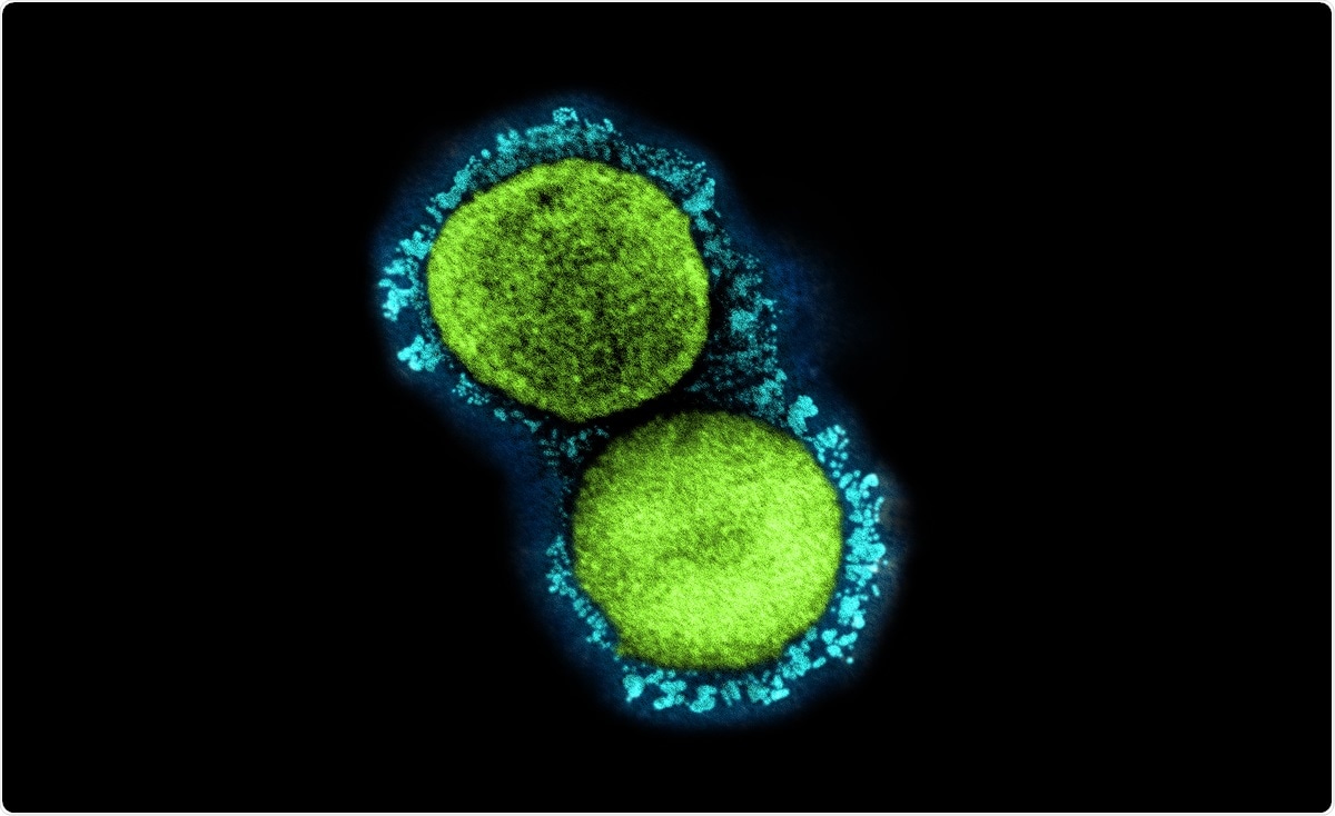 Study: Immune Correlates of Protection by mRNA-1273 Immunization against SARS-CoV-2 Infection in Nonhuman Primates. Image Credit: NIAID