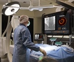 Abbott’s new imaging platform powered by Ultreon 1.0 Software launches in Europe