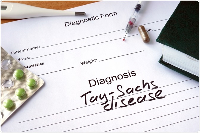 Image Credit: Vitalii Vodolazskyi / Shutterstock