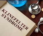 Klinefelter Syndrome Treatment