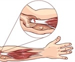 Tennis Elbow Exercises
