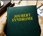 Joubert Syndrome Genetics
