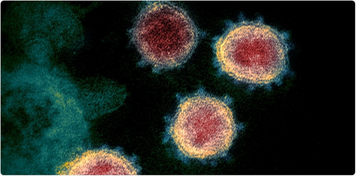 Study: Computational Approaches to Discover Novel Natural Compounds for SARS-CoV-2 Therapeutics. Image Credit: NIAID / Flickr