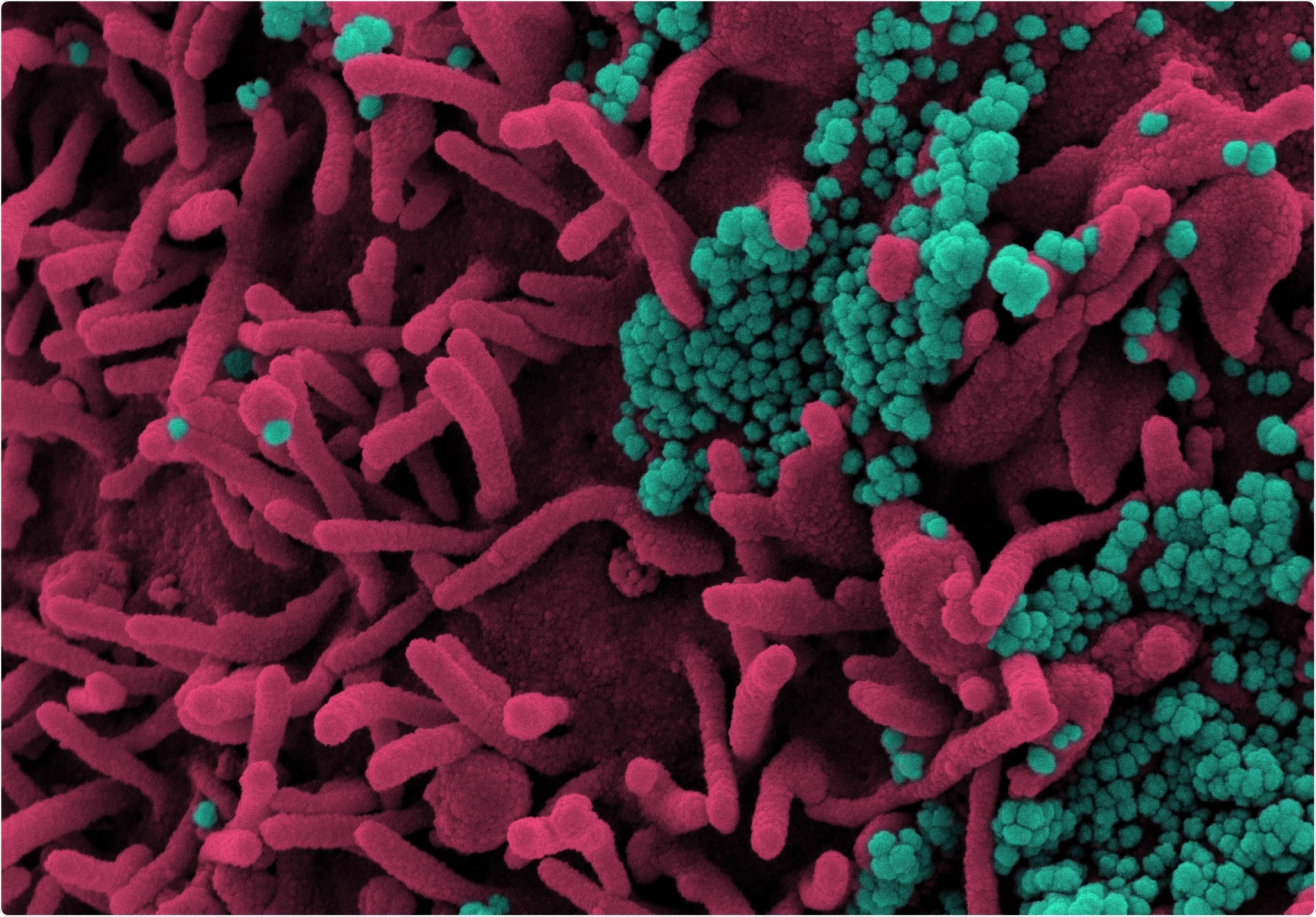 Study: CV2CoV, an enhanced mRNA-based SARS-CoV-2 vaccine candidate, supports higher protein expression and improved immunogenicity in rats. Image Credit: NIAID