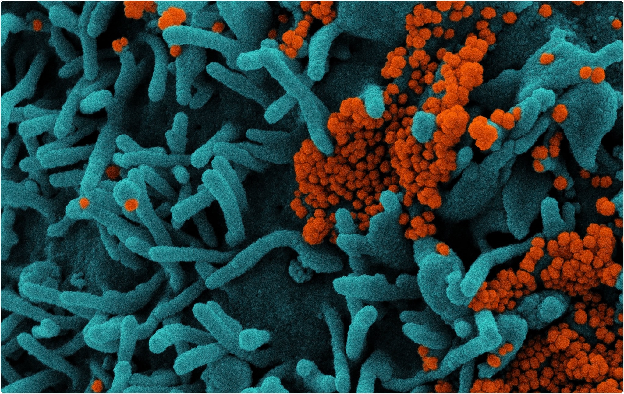 Study: A blood atlas of COVID-19 defines hallmarks of disease severity and specificity. Image Credit: NIAID