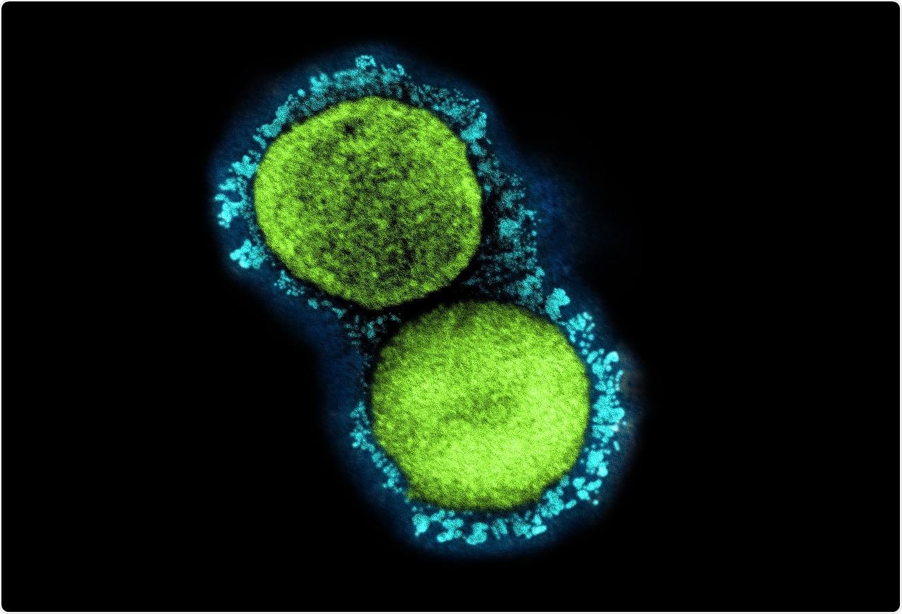 Study: Serial interval of COVID-19 and the effect of Variant B.1.1.7: analyses from a prospective community cohort study (Virus Watch). Image Credit: NIAID