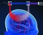 New, non-invasive method measures brain blood flow with light
