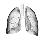 Idiopathic Pulmonary Fibrosis Treatment