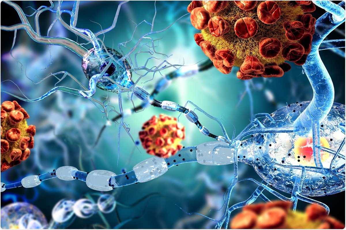 Study: Markers of brain and endothelial Injury and inflammation are acutely and sex specifically regulated in SARS-CoV-2 infection. Image Credit: Ralwell / Shutterstock