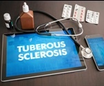 Tuberous Sclerosis Diagnosis