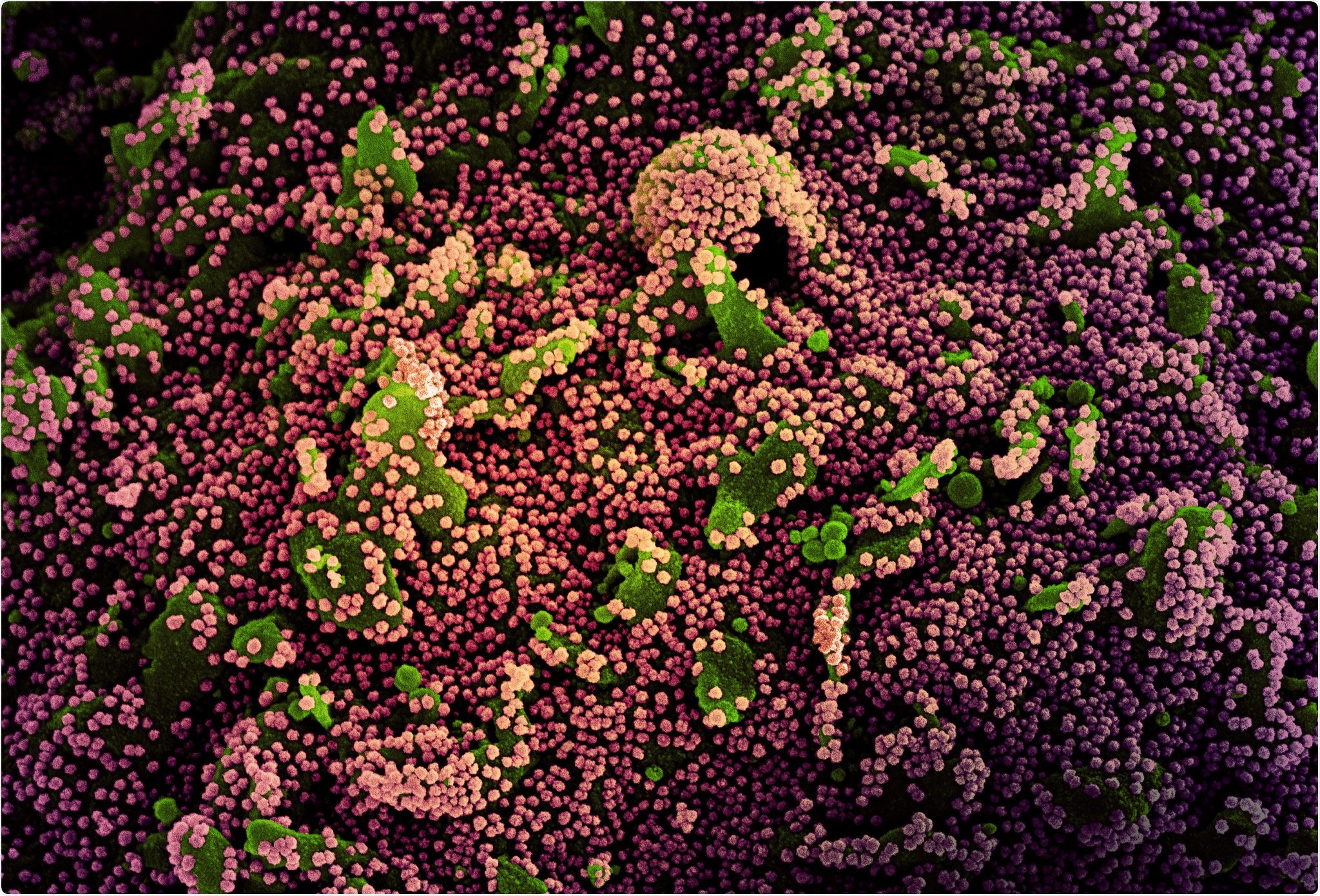 Study: Prevention and Attenuation of COVID-19 by BNT162b2 and mRNA-1273 Vaccines. Image Credit: NIAID