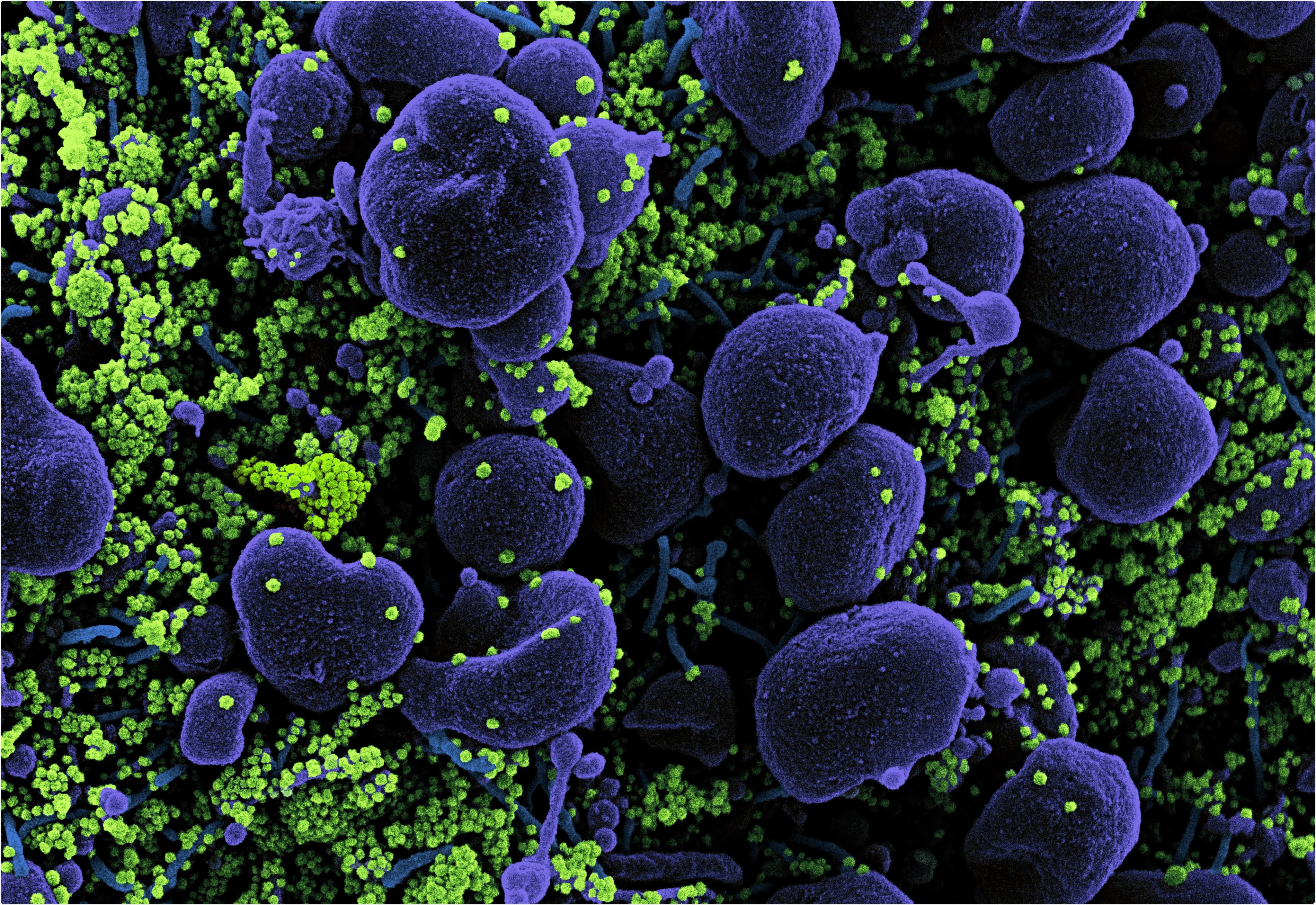 Study: Mitigating airborne transmission of SARS-CoV-2. Image Credit: NIAID