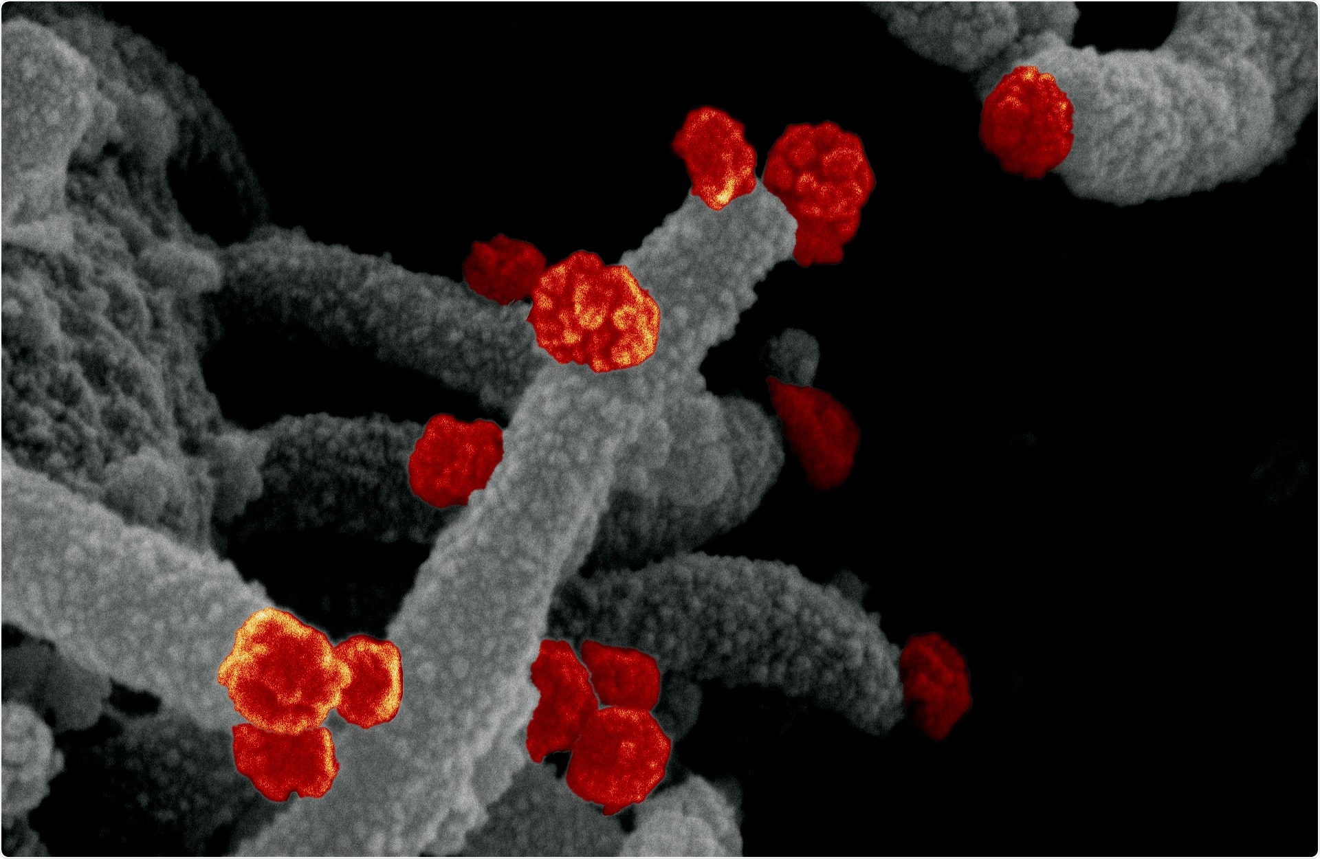 Study: SARS-CoV-2 Breakthrough Infections in Fully Vaccinated Individuals. Image Credit: NIAID