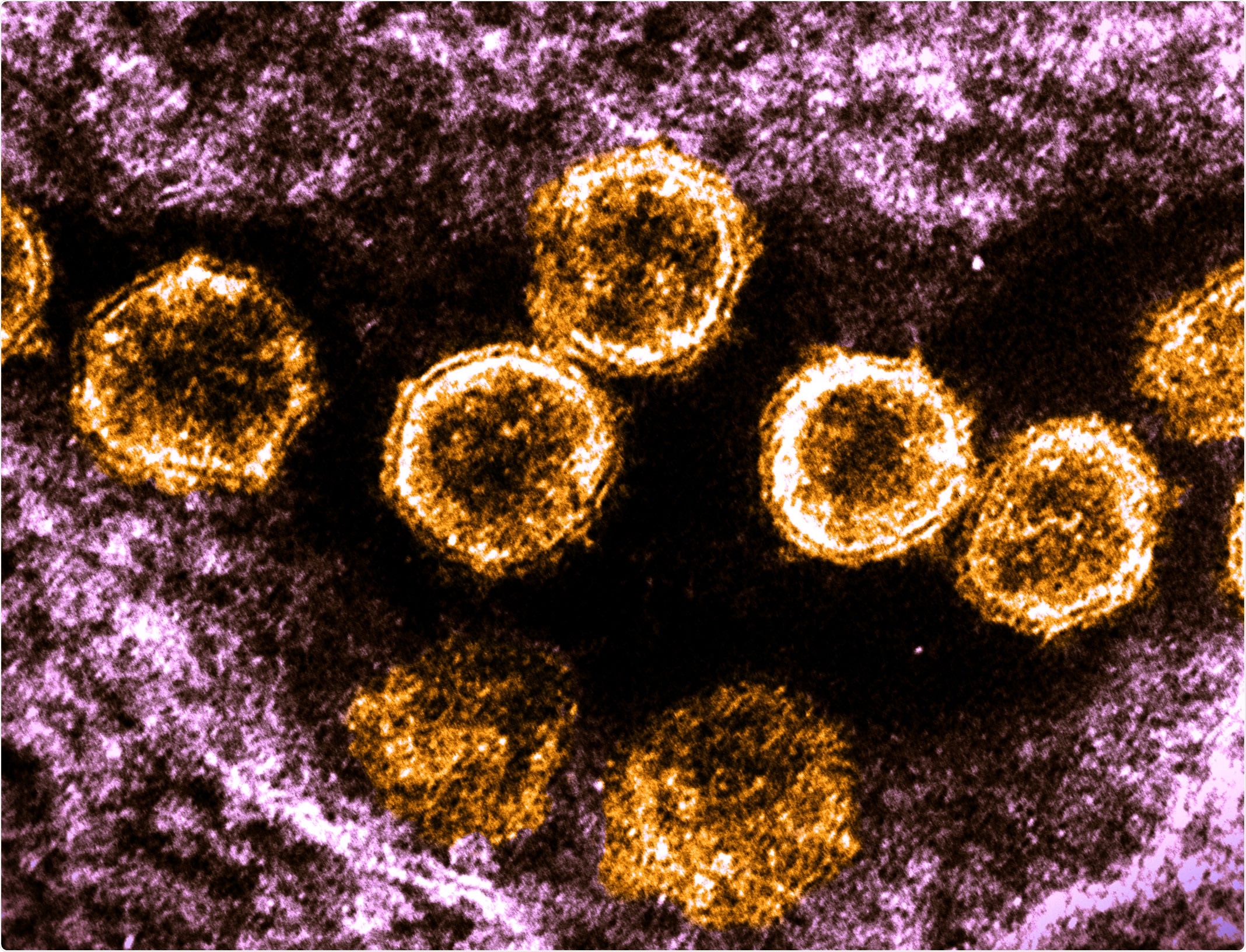 NEJM Special Report: SARS-CoV-2 Variants and Vaccines. Image Credit: NIAID