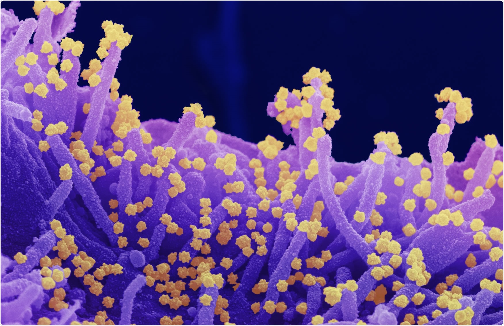 Study: Seroconversion panels demonstrate anti-SARS-CoV-2 antibody development after administration of the mRNA-1273 vaccine. Image Credit: NIAID