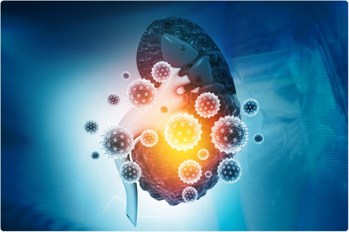 Study: Urine test predicts kidney injury and death in COVID-19. Image Credit: Explode / Shutterstock