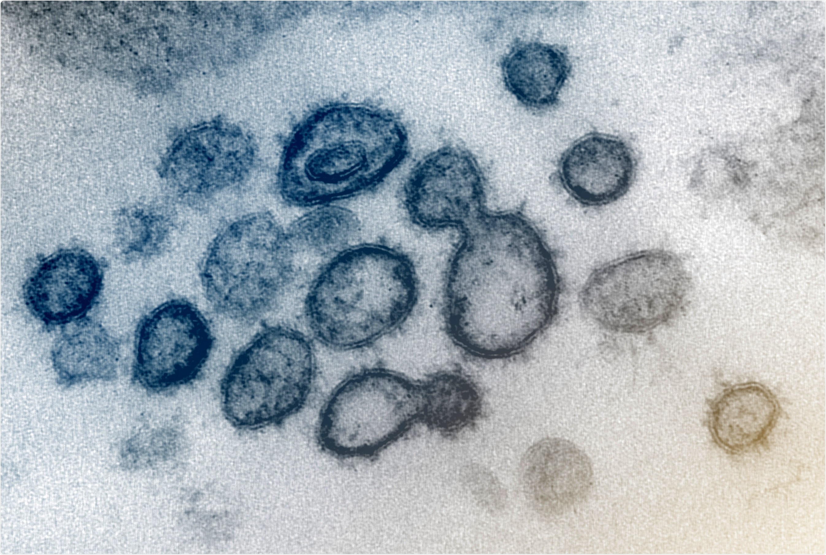 Study: BNT162b2 vaccine breakthrough: clinical characteristics of 152 fully-vaccinated hospitalized COVID-19 patients in Israel. Image Credit: NIAID