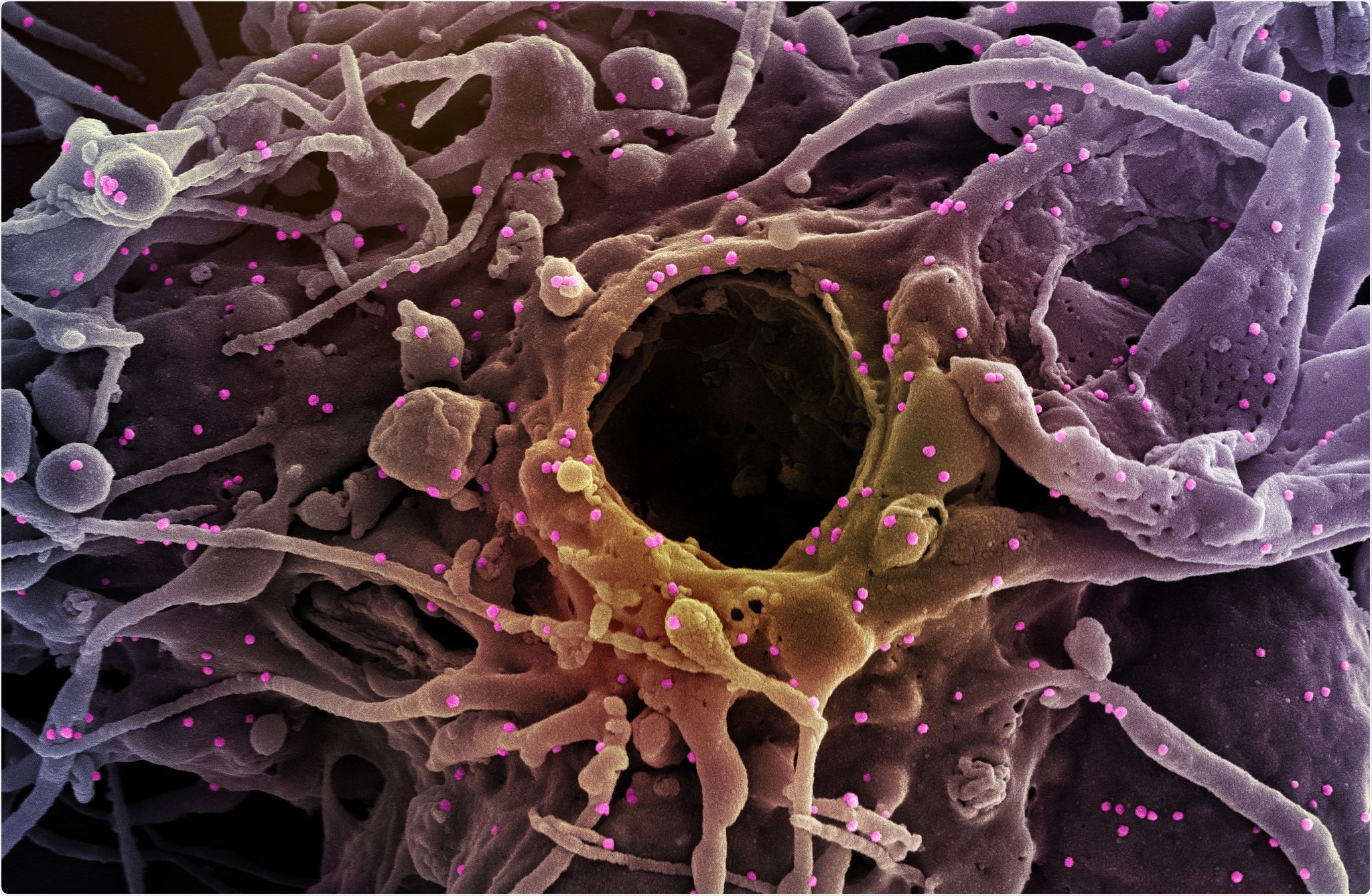 Study: Dominance of Alpha and Iota variants in SARS-CoV-2 vaccine breakthrough infections in New York City. Image Credit: NIAID