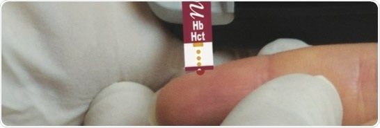 Capillary blood testing for lactate, Hb, and Hct with the StatStrip® LAC/Hb/Hct