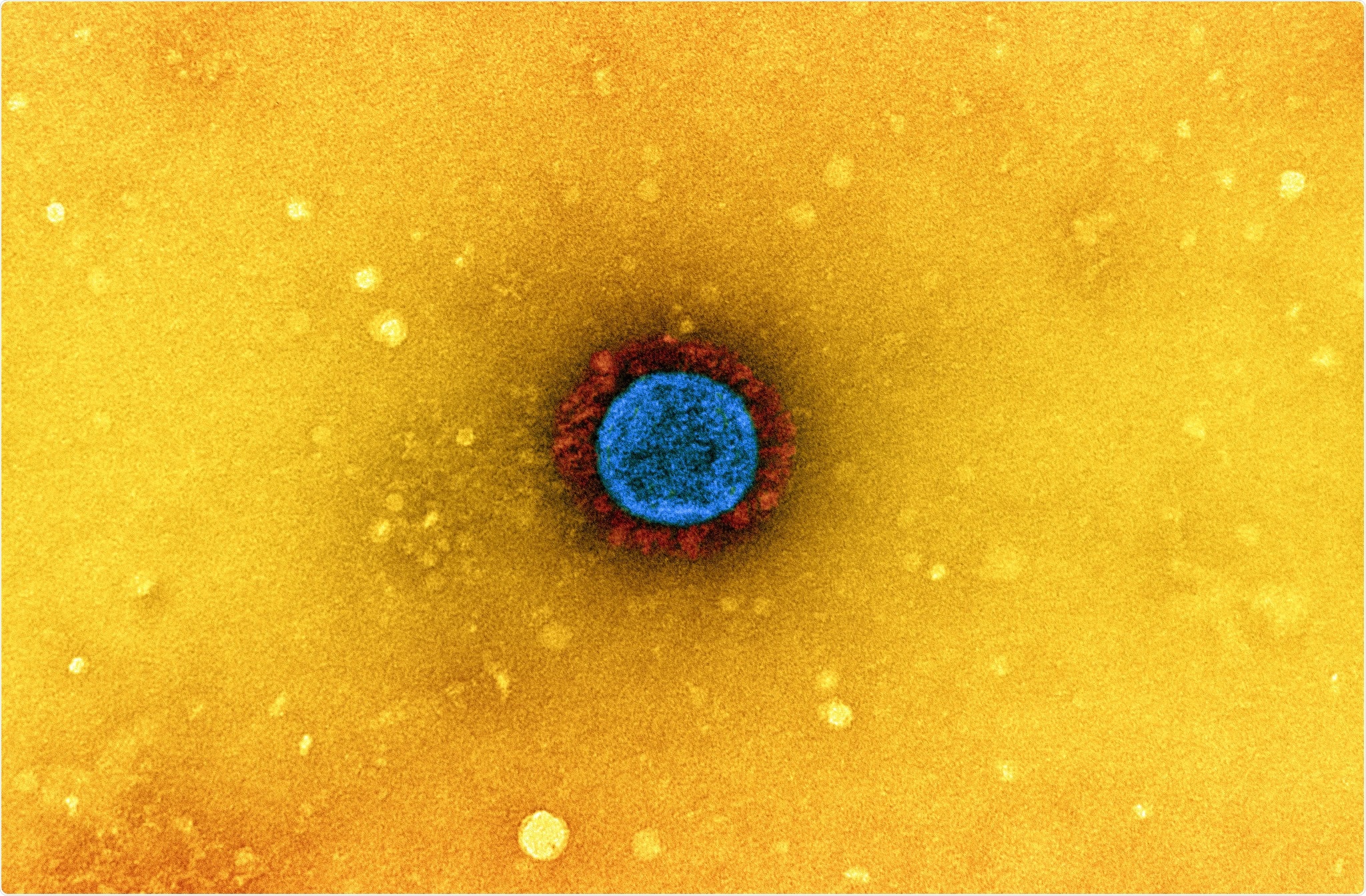 Study: Serum antibody response to BNT162b2 after natural SARS-CoV-2 infection. Image Credit: NIAID