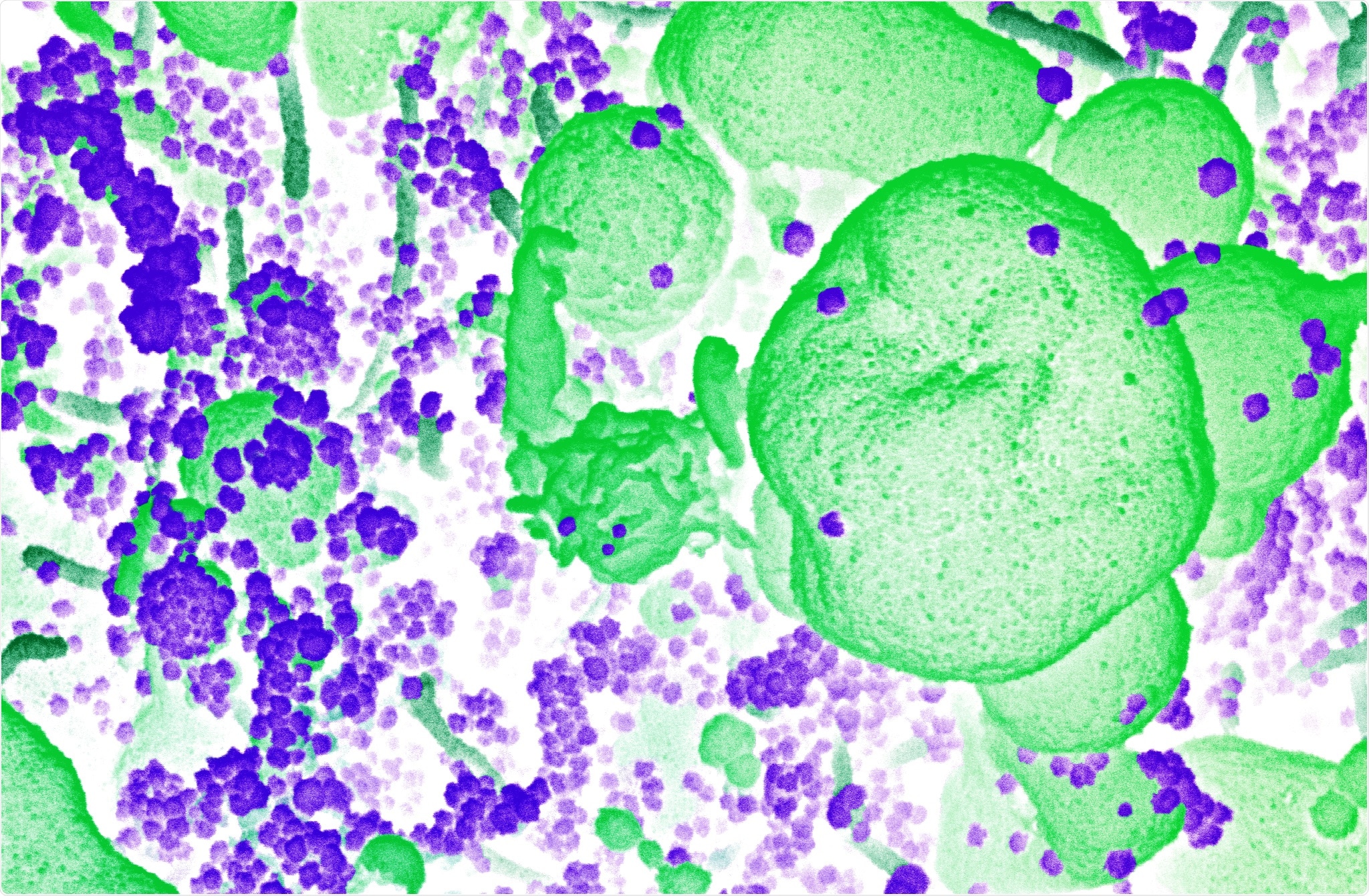 Study: Reduced Risk of Reinfection with SARS-CoV-2 After COVID-19 Vaccination — Kentucky, May–June 2021. Image Credit: NIAID