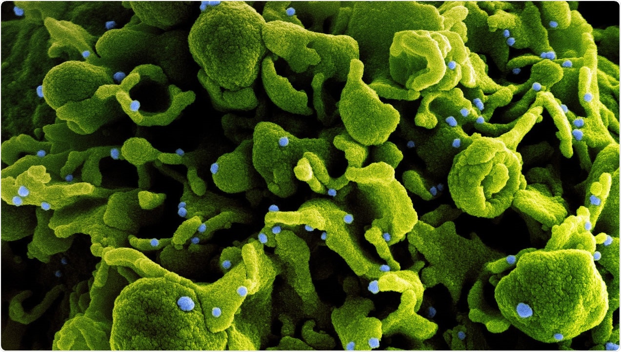 Study: The SARS-CoV-2 spike (S) and the orthoreovirus p15 cause neuronal and glial fusion. Image Credit: NIAID
