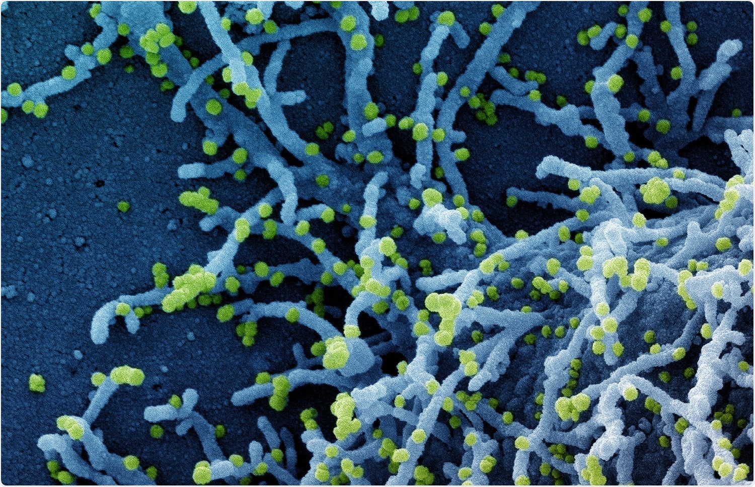Study: Co-expression analysis to identify key modules and hub genes associated with COVID19 in Platelets. Image Credit: NIAID