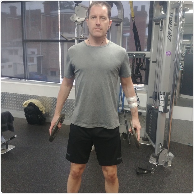 New guidelines outline physical activities that are safe for dialysis patients