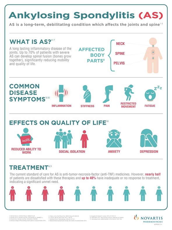 Ankylosing Spondylitis infographic